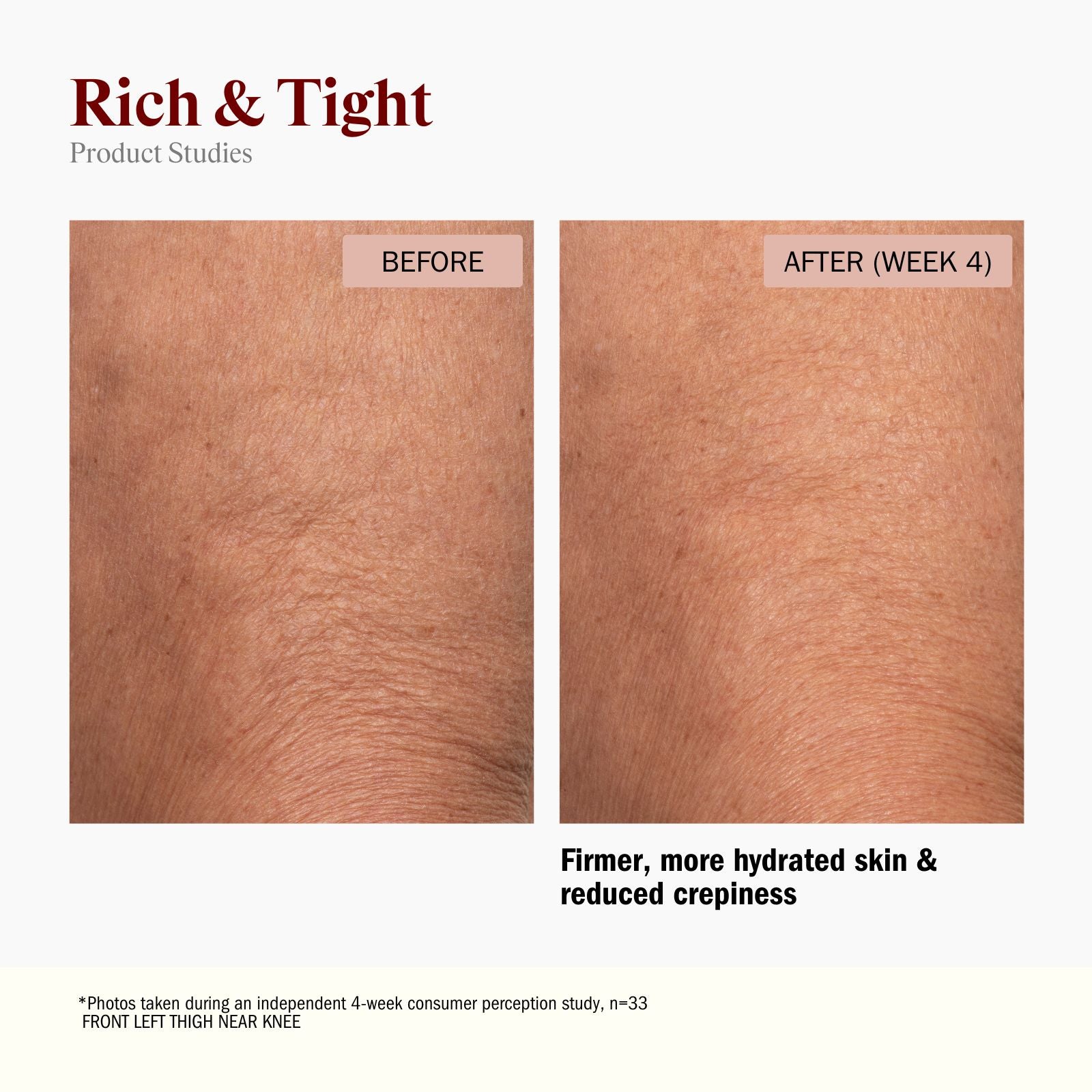 Before and after comparison of skin texture on a thigh, showing firmer and more hydrated skin after 4 weeks.