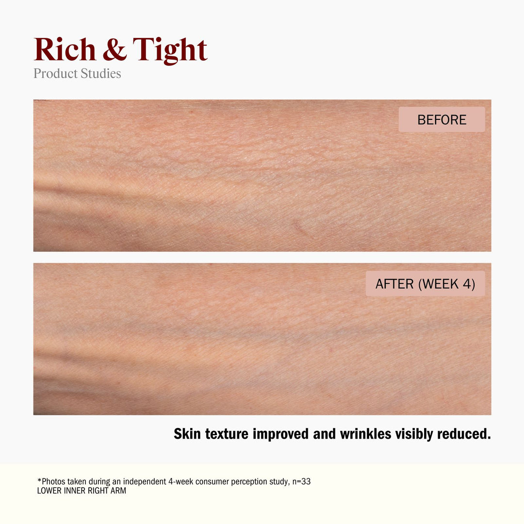 Before and after comparison of skin texture on a thigh, showing firmer and more hydrated skin after 4 weeks. Skin texture improved and wrinkles visibly reduce.