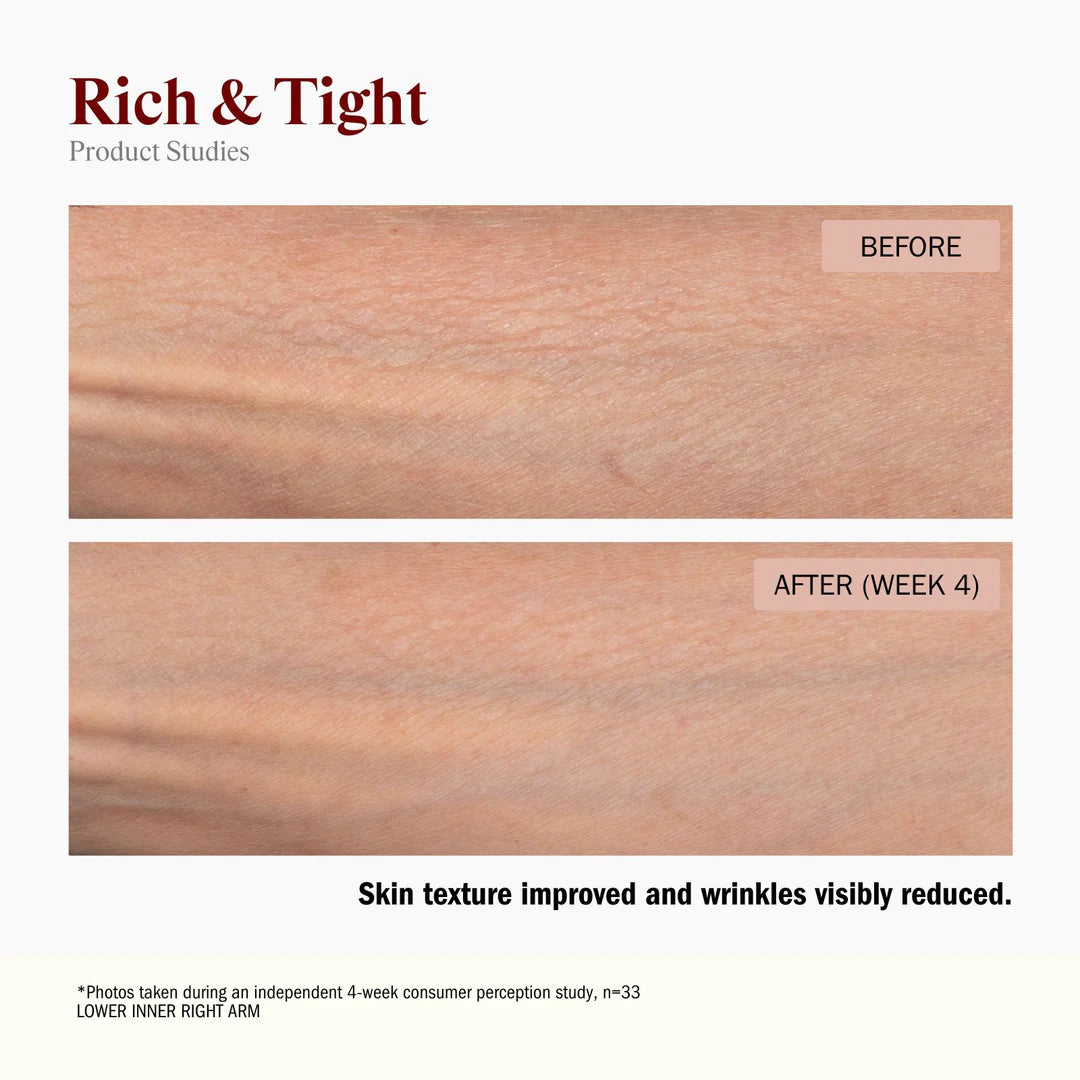 Rich & Tight