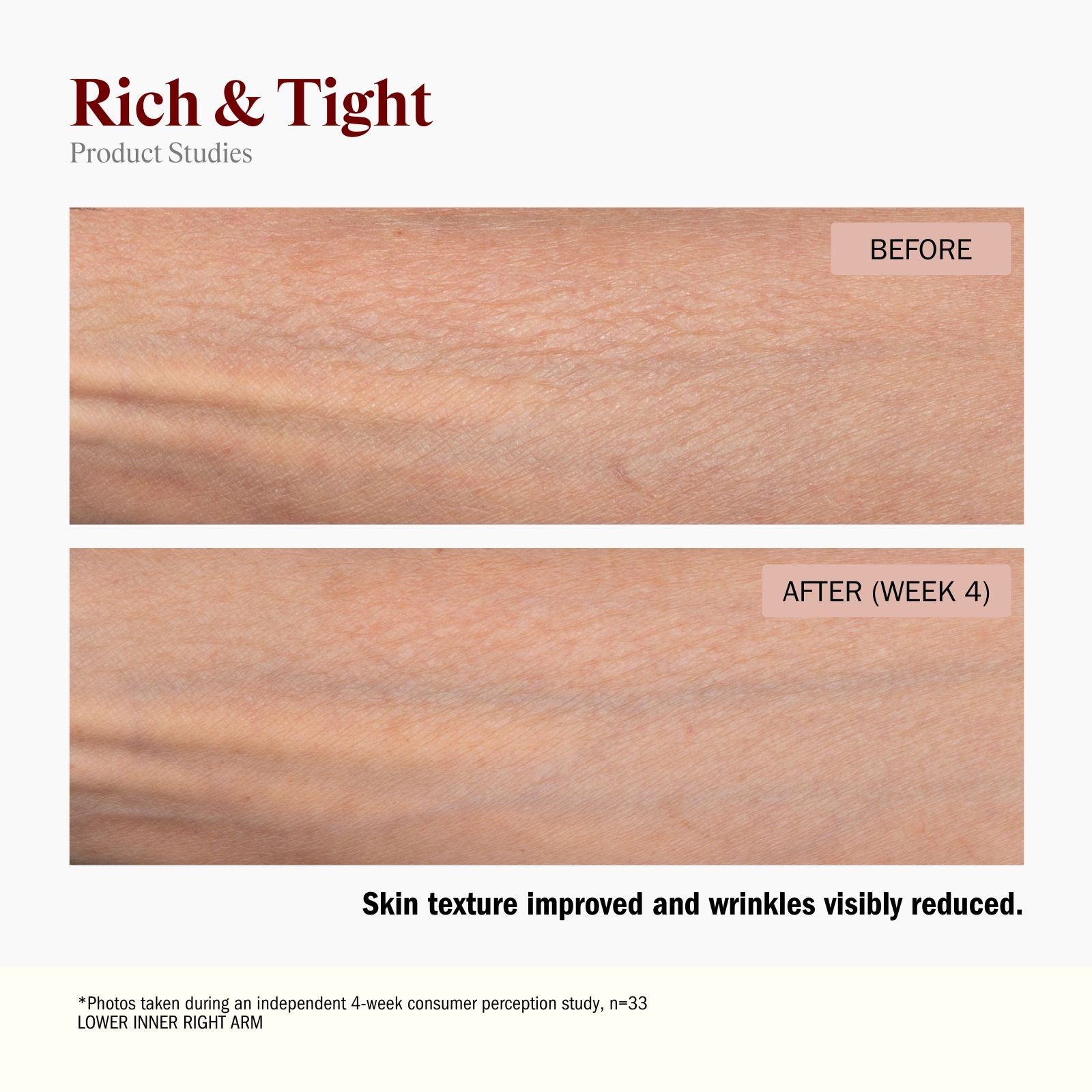 Before and after comparison of skin texture on a thigh, showing firmer and more hydrated skin after 4 weeks. Skin texture improved and wrinkles visibly reduce.